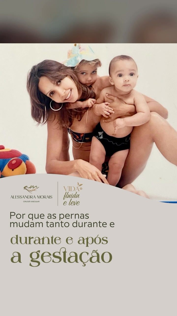 Por que as pernas mudam tanto durante e após a gestação?
Durante a gravidez, o corpo passa por diversas adaptações para