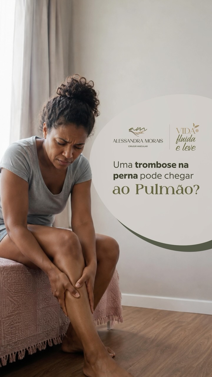 Uma trombose na perna pode chegar ao pulmão?
Pode. E é justamente por isso que reconhecer os sinais de uma trombose ven